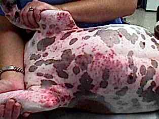 Если доктор находит на коже признаки болезни другого органа, он назначает подробную диагностику и консультации узких специалистов