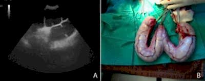 Пиометра (воспаление матки) у кошек