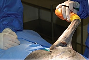 Злокачественные опухоли специфичны быстрым ростом, рецидивом и метастазами