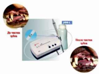 Зубной камень - известковое отложение, образующееся в полости рта