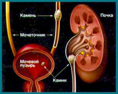 От мочекаменной чаще всего страдают коты из-за длинного, изогнутого мочеточника, по которому плохо проходят песок и камни.
