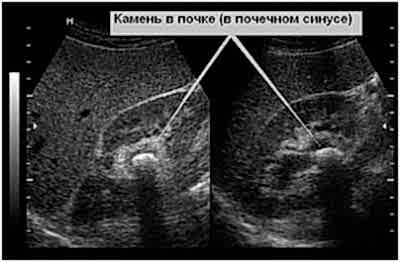 Если питомец имеет склонность к МКБ, то ему необходимо периодически делать снимки УЗИ.